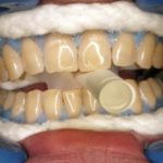 Zubní hygiena je základ zdravého chrupu