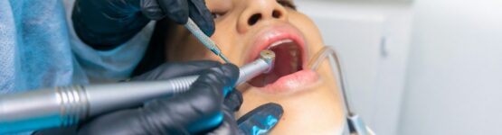 Zubni ordinace Praha 2 vam poskytne dokonalou peci o vase zuby